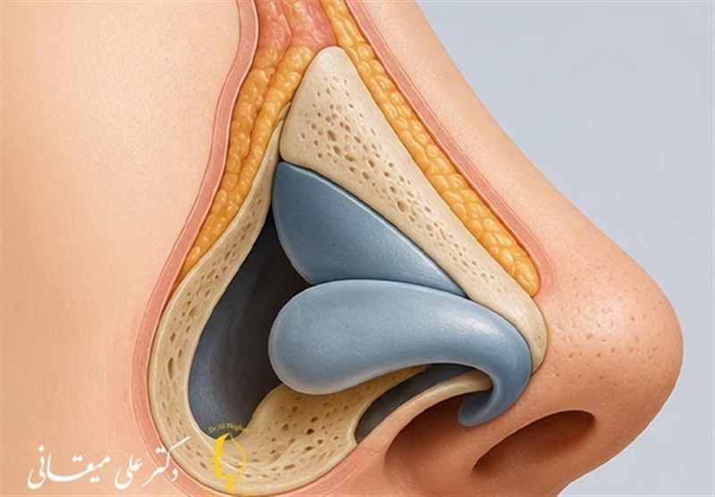 بینی گوشتی یا استخوانی؛ کدام برای جراحی با بی حسی موضعی مناسب تر است؟