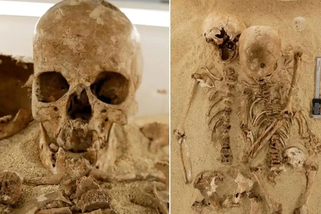 این اسکلت 12000 ساله دارای یک بیماری ژنتیکی نادر است!