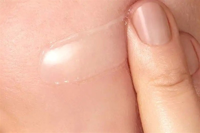 نکات لازم برای داشتن پوست شاداب؛ از روتین پوستی تا تغذیه