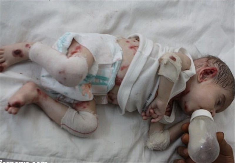 8 اسفند؛ روز حمایت از بیماران نادر و فریاد خاموش دردهای نادیده