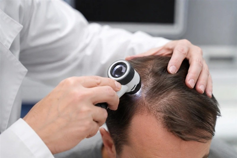 برای کاشت مو عجله نکنید؛ شاید راه ساده‌تری برای پرپشت شدن مو باشد